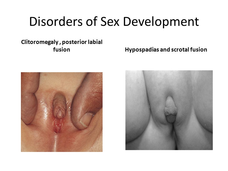 Disorders Sex 15
