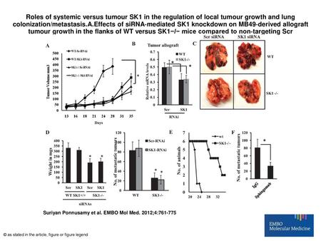Roles of systemic versus tumour SK1 in the regulation of local tumour growth and lung colonization/metastasis.A.Effects of siRNA‐mediated SK1 knockdown.