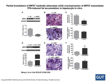 Partial knockdown of MPST markedly attenuates while overexpression of MPST exacerbates FFA-induced fat accumulation in hepatocyte in vitro. Partial knockdown.