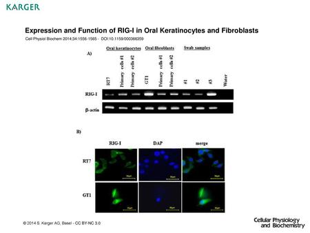 Expression and Function of RIG-I in Oral Keratinocytes and Fibroblasts
