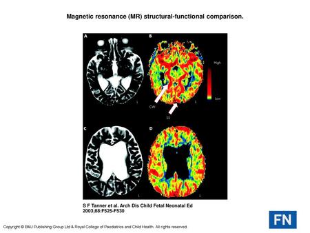 Magnetic resonance (MR) structural-functional comparison.