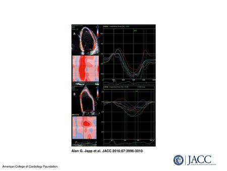 Alan G. Japp et al. JACC 2016;67:2996-3010 Differentiation of Athlete’s Heart From Early DCM by Myocardial Deformation Imaging Two-dimensional speckle.