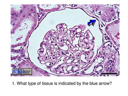 What type of tissue is indicated by the blue arrow?