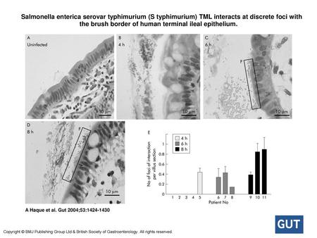  Salmonella enterica serovar typhimurium (S typhimurium) TML interacts at discrete foci with the brush border of human terminal ileal epithelium.  Salmonella.