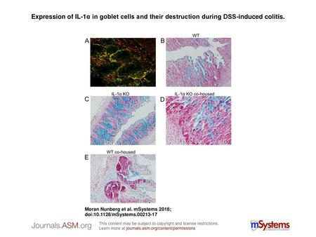 Expression of IL-1α in goblet cells and their destruction during DSS-induced colitis. Expression of IL-1α in goblet cells and their destruction during.