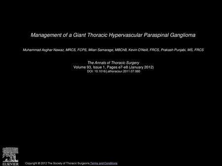 Management of a Giant Thoracic Hypervascular Paraspinal Ganglioma