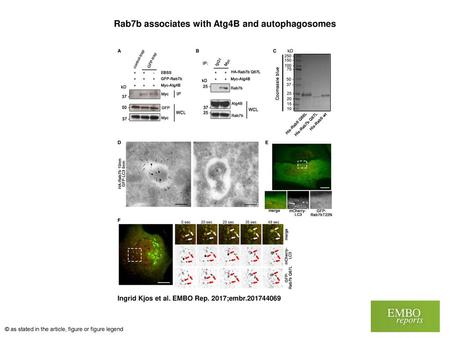 Rab7b associates with Atg4B and autophagosomes