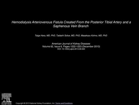 Hemodialysis Arteriovenous Fistula Created From the Posterior Tibial Artery and a Saphenous Vein Branch  Taiga Hara, MD, PhD, Tadashi Sofue, MD, PhD,