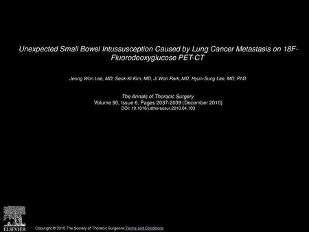 Unexpected Small Bowel Intussusception Caused by Lung Cancer Metastasis on 18F- Fluorodeoxyglucose PET-CT  Jeong Won Lee, MD, Seok-Ki Kim, MD, Ji Won Park,