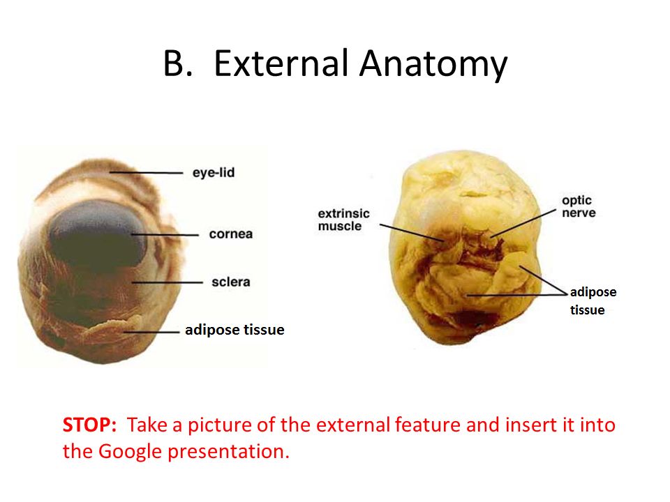 Eye Dissection Pictures 108