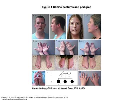 Figure 1 Clinical features and pedigree