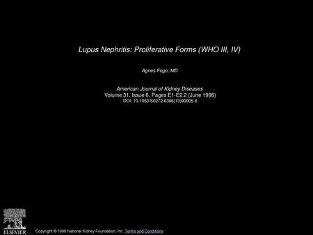 Lupus Nephritis: Proliferative Forms (WHO III, IV)