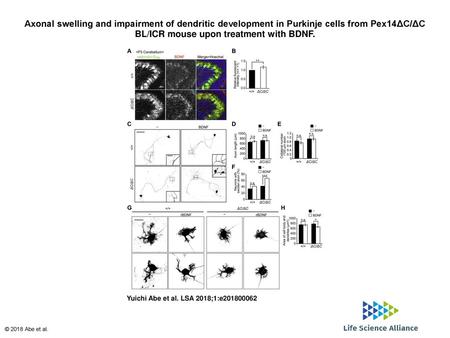 Axonal swelling and impairment of dendritic development in Purkinje cells from Pex14ΔC/ΔC BL/ICR mouse upon treatment with BDNF. Axonal swelling and impairment.
