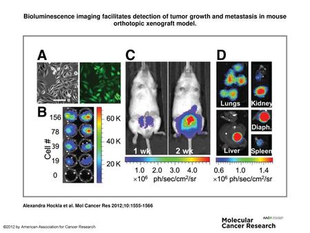 Bioluminescence imaging facilitates detection of tumor growth and metastasis in mouse orthotopic xenograft model. Bioluminescence imaging facilitates detection.