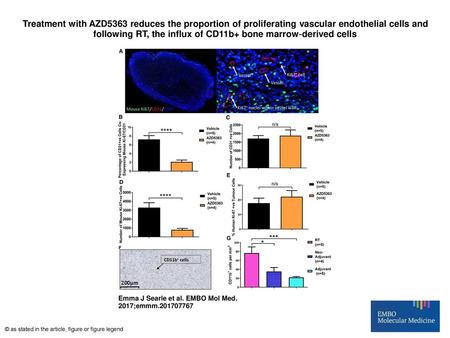 Treatment with AZD5363 reduces the proportion of proliferating vascular endothelial cells and following RT, the influx of CD11b+ bone marrow‐derived cells.