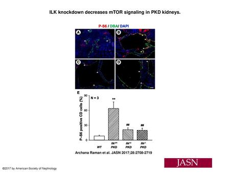 ILK knockdown decreases mTOR signaling in PKD kidneys.