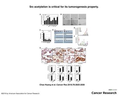 Src acetylation is critical for its tumorogenesis property.