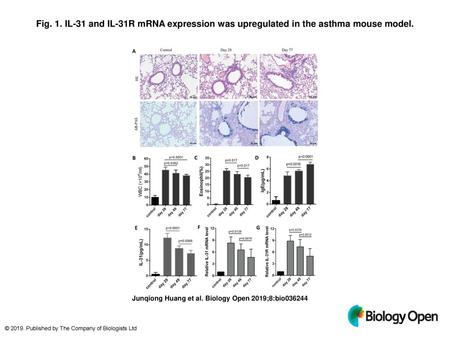 Fig. 1. IL-31 and IL-31R mRNA expression was upregulated in the asthma mouse model. IL-31 and IL-31R mRNA expression was upregulated in the asthma mouse.