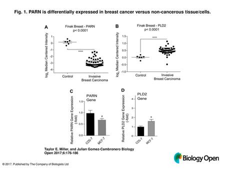 Fig. 1. PARN is differentially expressed in breast cancer versus non-cancerous tissue/cells. PARN is differentially expressed in breast cancer versus non-cancerous.