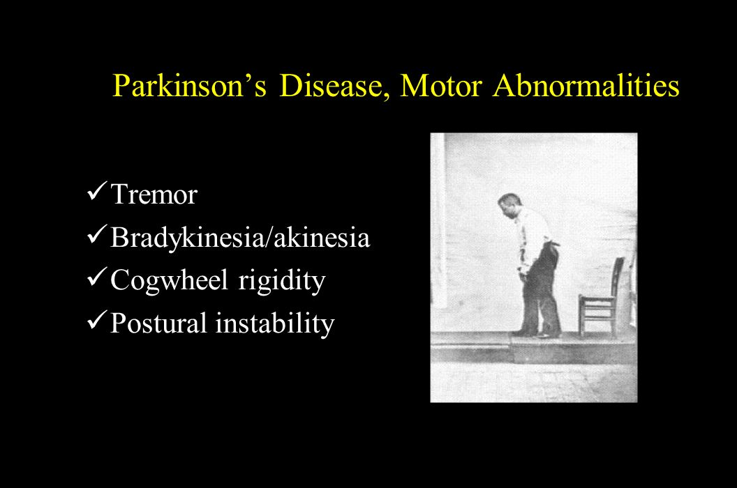 Parkinson’s Disease, Motor Abnormalities