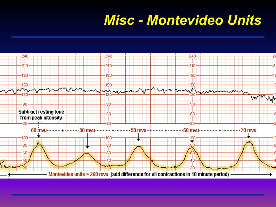 Misc - Montevideo Units