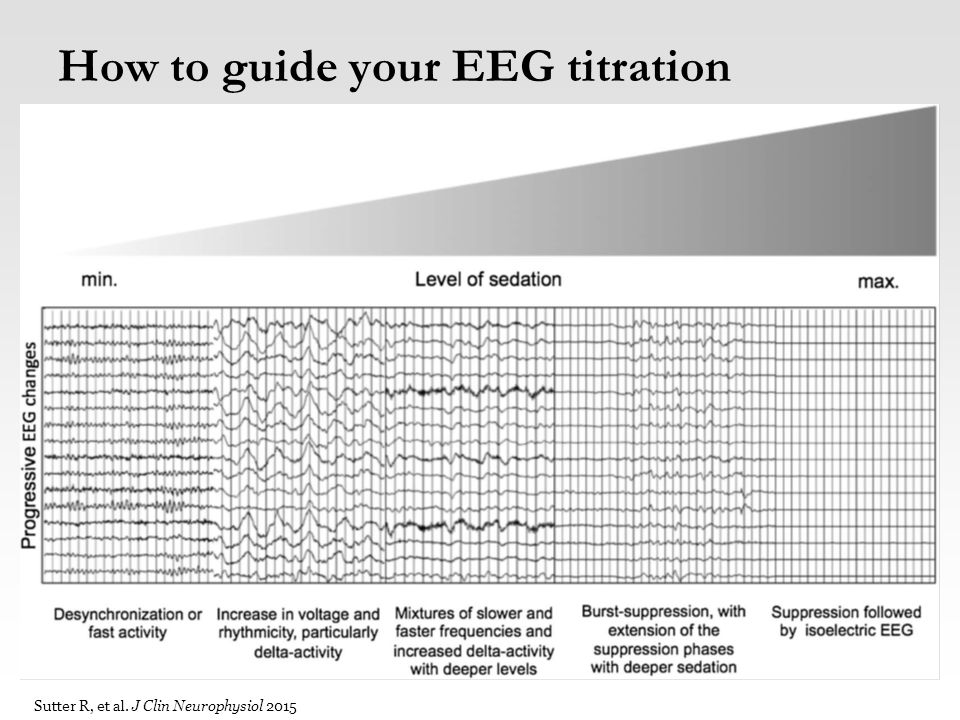 How to guide your EEG titration