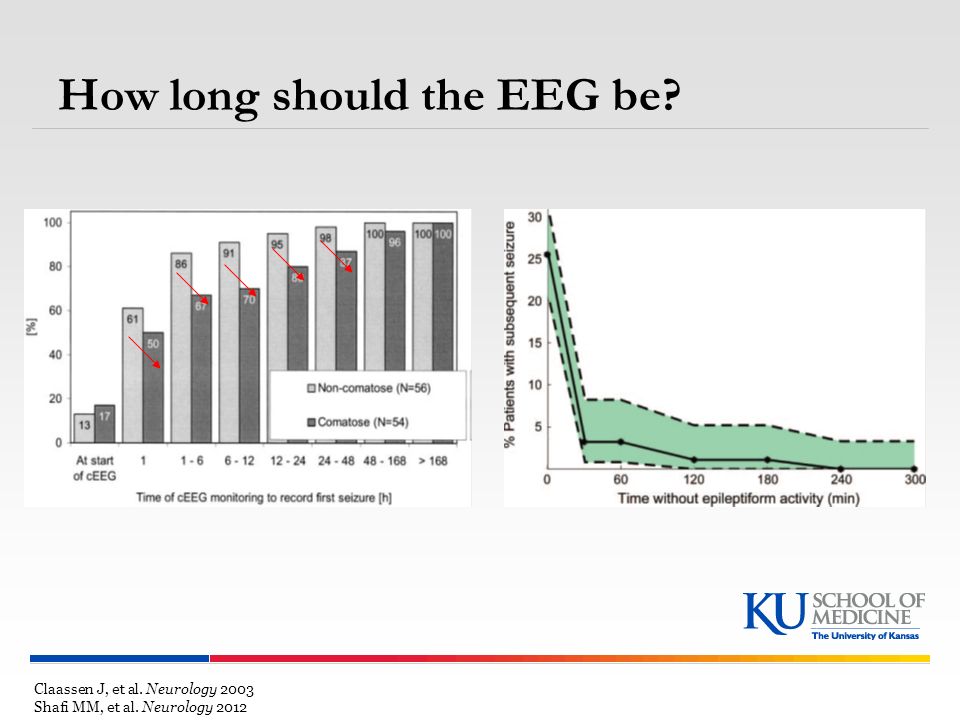 How long should the EEG be