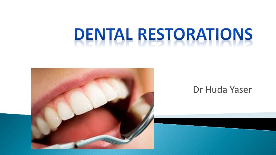 Dental Restorations Dr Huda Yaser Ppt Video Online Download