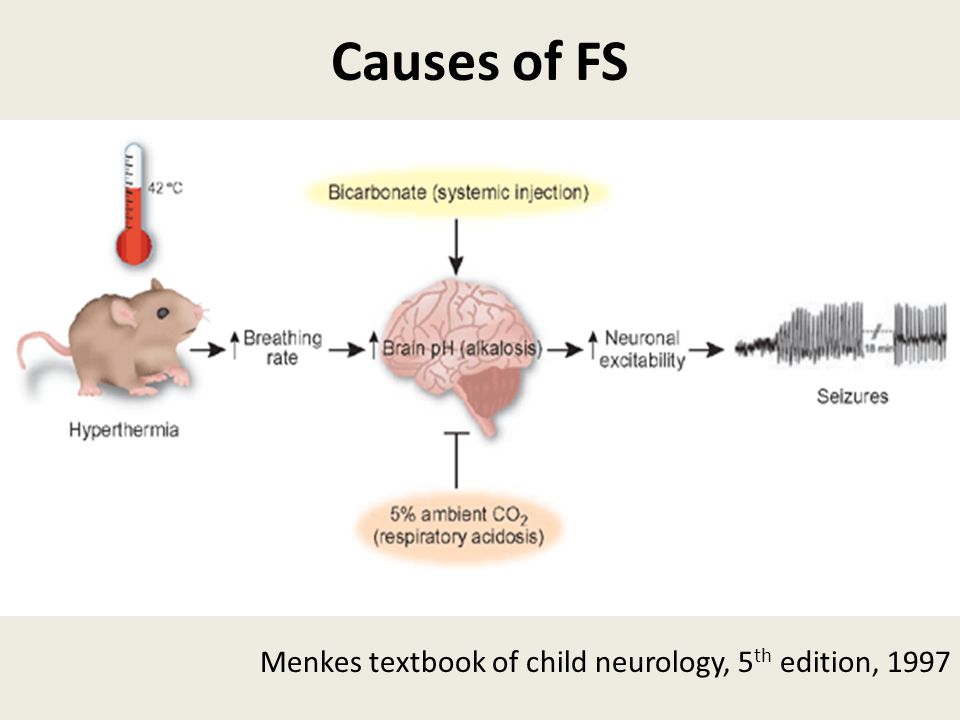 Causes of FS Menkes textbook of child neurology, 5th edition, 1997