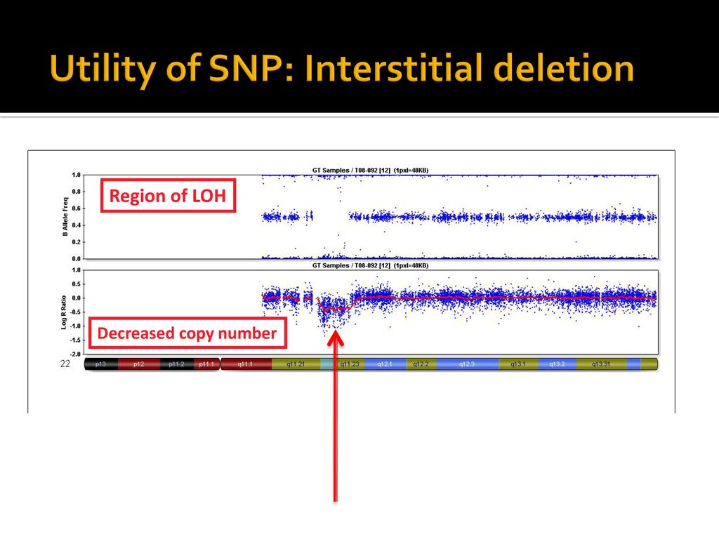 Utility of SNP: Interstitial deletion