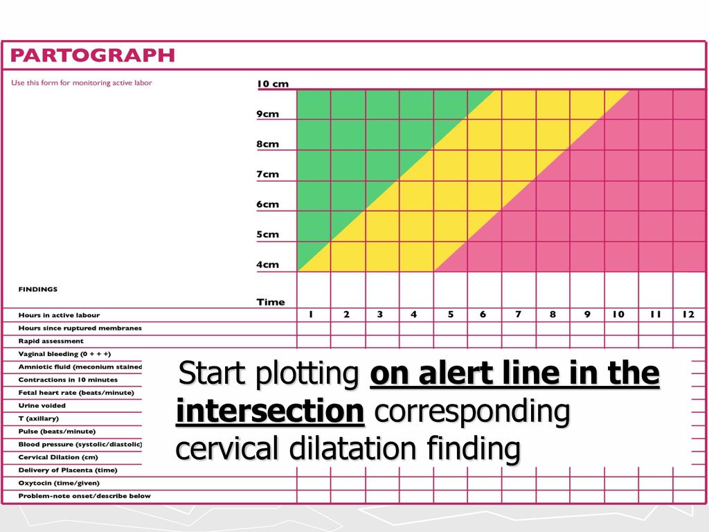 Start plotting on alert line in the intersection corresponding cervical dilatation finding