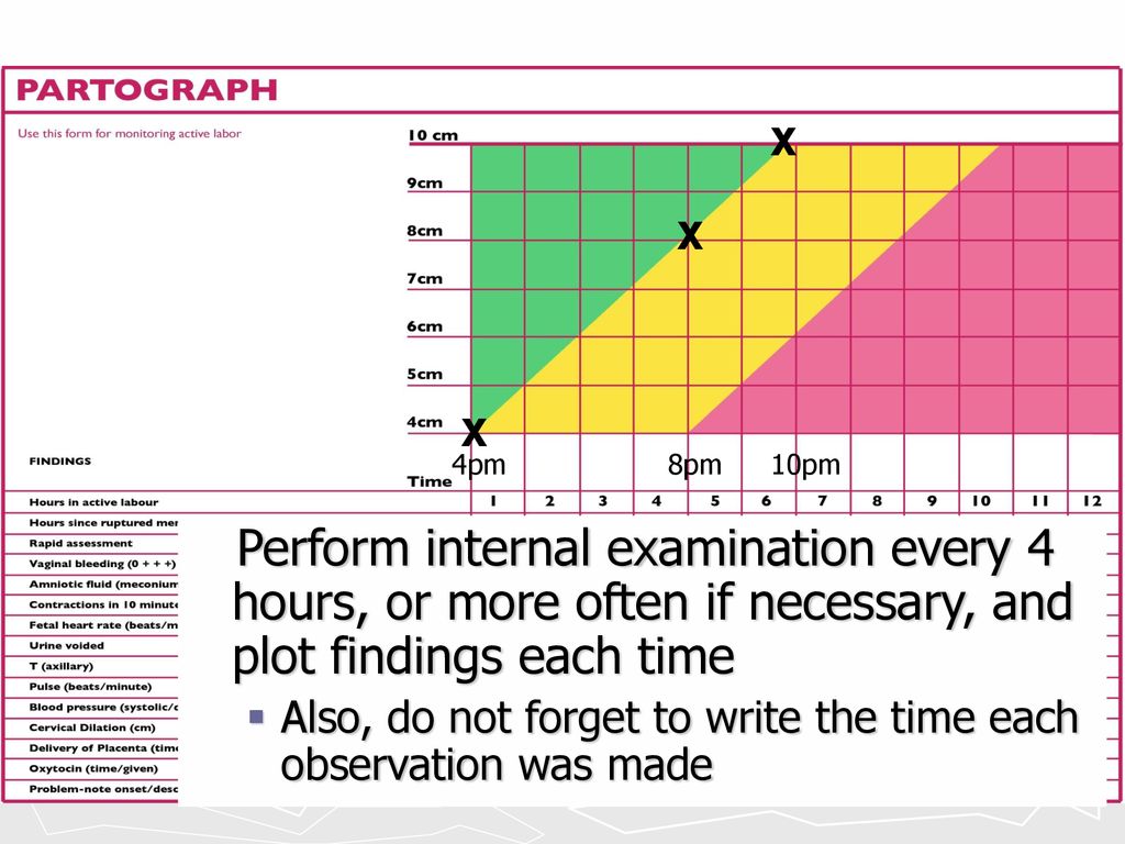 X X. X. 4pm. 8pm. 10pm. Perform internal examination every 4 hours, or more often if necessary, and plot findings each time.