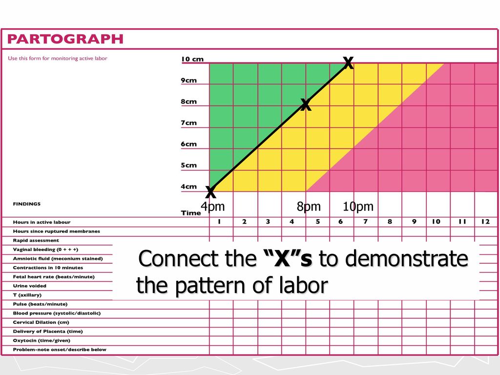 Connect the X s to demonstrate the pattern of labor