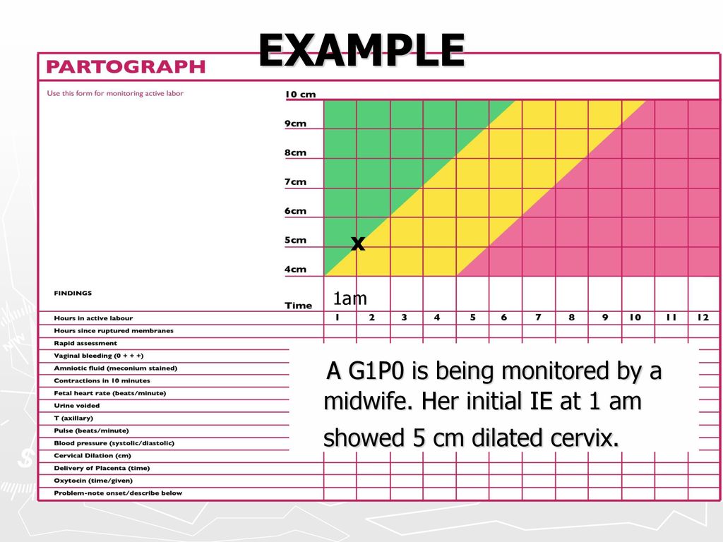 EXAMPLE x. 1am. A G1P0 is being monitored by a midwife. Her initial IE at 1 am showed 5 cm dilated cervix.