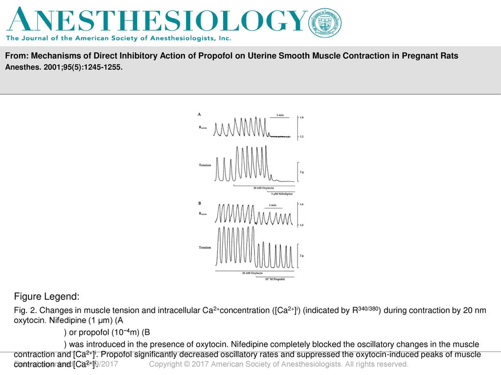 From: Mechanisms of Direct Inhibitory Action of Propofol on Uterine Smooth Muscle Contraction in Pregnant Rats