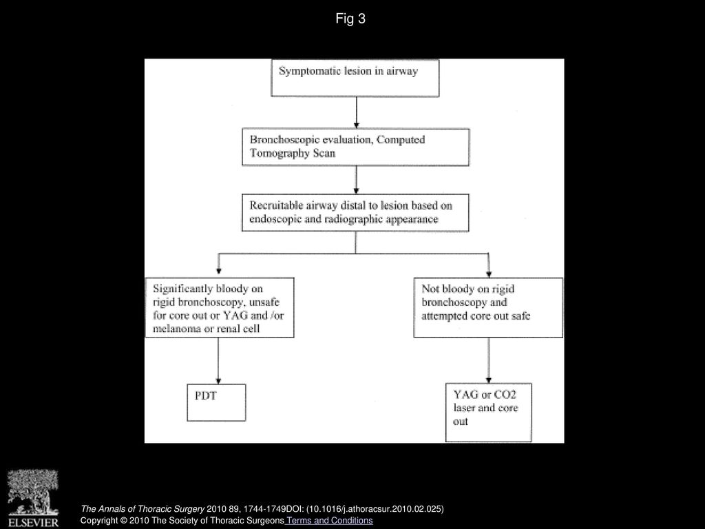 Fig 3 Suggested algorithm for role of photodynamic therapy (PDT) in endobronchial disease.