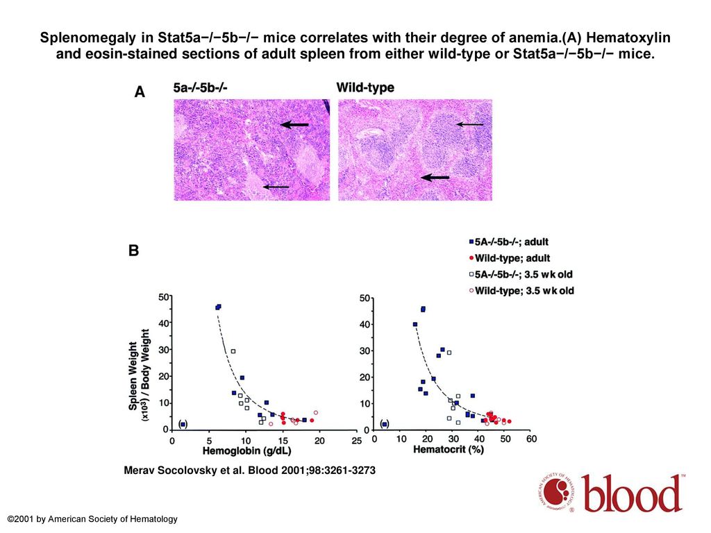 Splenomegaly in Stat5a−/−5b−/− mice correlates with their degree of anemia.(A) Hematoxylin and eosin-stained sections of adult spleen from either wild-type or Stat5a−/−5b−/− mice.