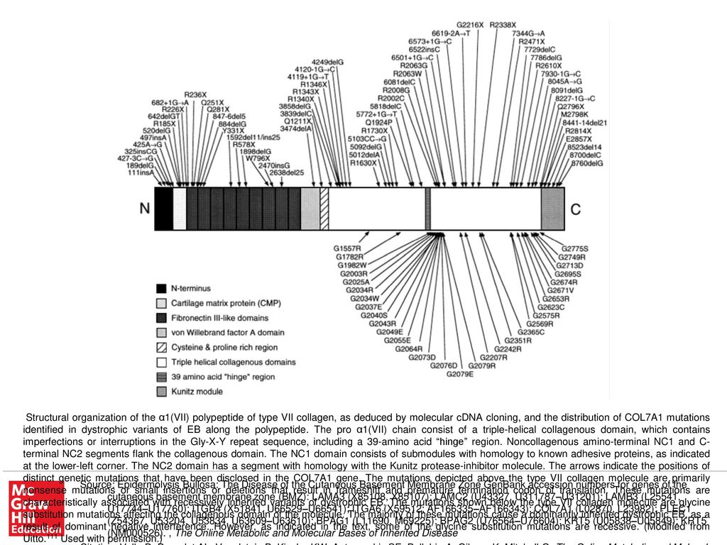 Structural organization of the α1(VII) polypeptide of type VII collagen, as deduced by molecular cDNA cloning, and the distribution of COL7A1 mutations identified in dystrophic variants of EB along the polypeptide. The pro α1(VII) chain consist of a triple-helical collagenous domain, which contains imperfections or interruptions in the Gly-X-Y repeat sequence, including a 39-amino acid hinge region. Noncollagenous amino-terminal NC1 and C-terminal NC2 segments flank the collagenous domain. The NC1 domain consists of submodules with homology to known adhesive proteins, as indicated at the lower-left corner. The NC2 domain has a segment with homology with the Kunitz protease-inhibitor molecule. The arrows indicate the positions of distinct genetic mutations that have been disclosed in the COL7A1 gene. The mutations depicted above the type VII collagen molecule are primarily nonsense mutations or small insertions or deletions that result in frameshift and premature termination codon of translation. These mutations are characteristically associated with recessively inherited variants of dystrophic EB. The mutations shown below the type VII collagen molecule are glycine substitution mutations affecting the collagenous domain of the molecule. The majority of these mutations cause a dominantly inherited dystrophic EB, as a result of dominant negative interference. However, as indicated in the text, some of the glycine substitution mutations are recessive. (Modified from Uitto.111 Used with permission.)