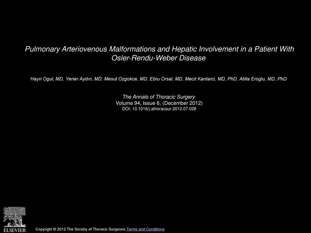 Pulmonary Arteriovenous Malformations and Hepatic Involvement in a Patient With Osler-Rendu-Weber Disease
