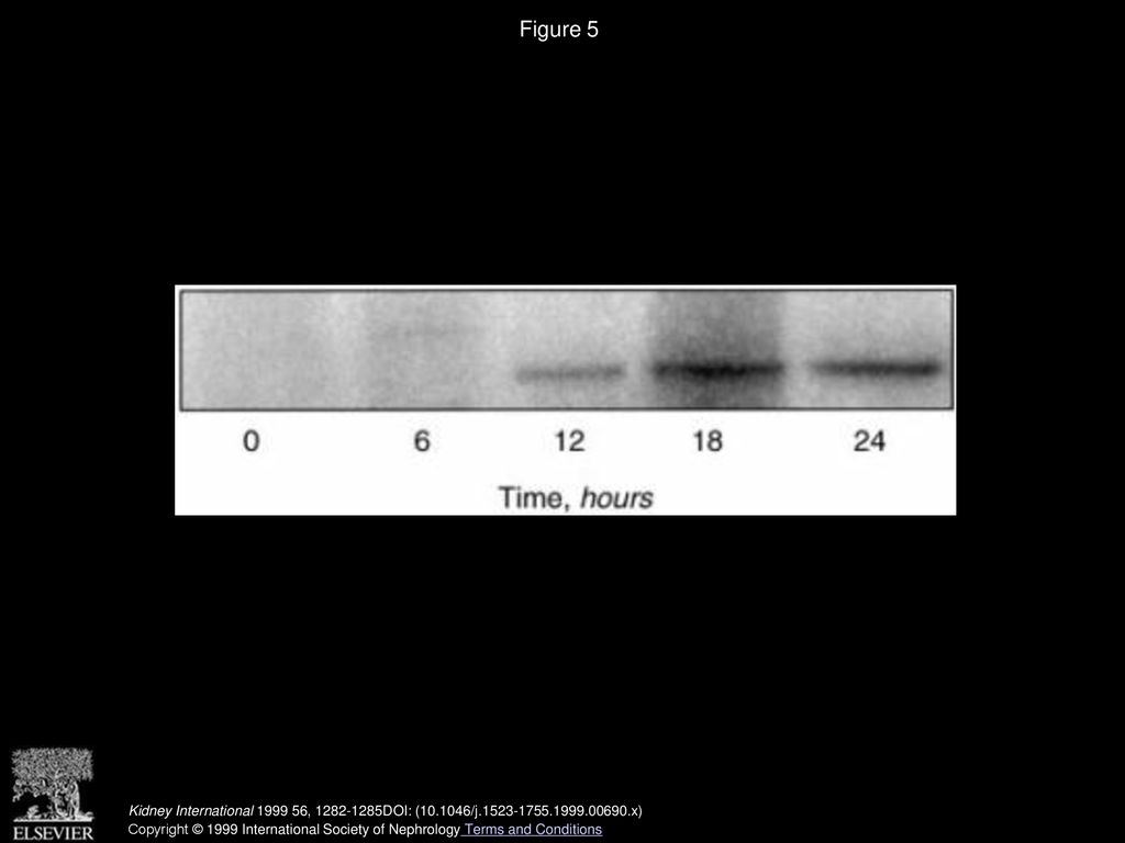 Figure 5 A representative experiment of the temporal profile of serum-induced cyclin D1/CDK4(6) kinase activity.