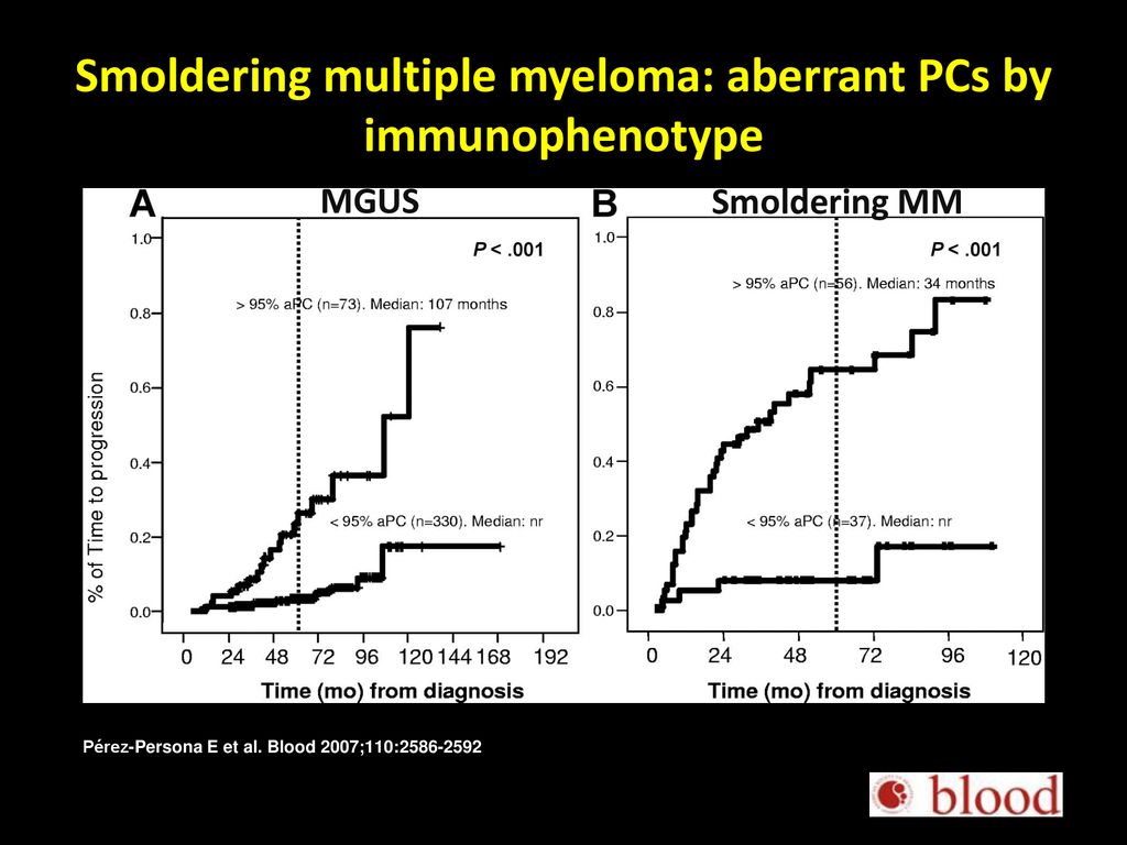 Smoldering multiple myeloma: aberrant PCs by immunophenotype