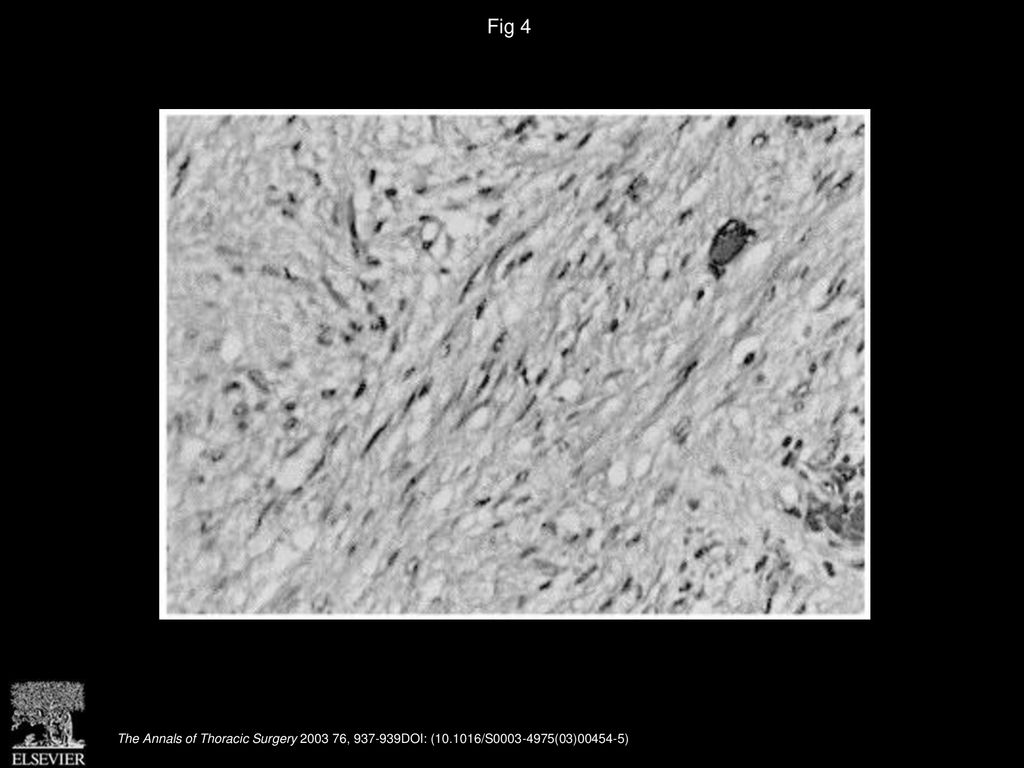 Fig 4 Histology (hematoxylin & eosin, original magnification ×115).