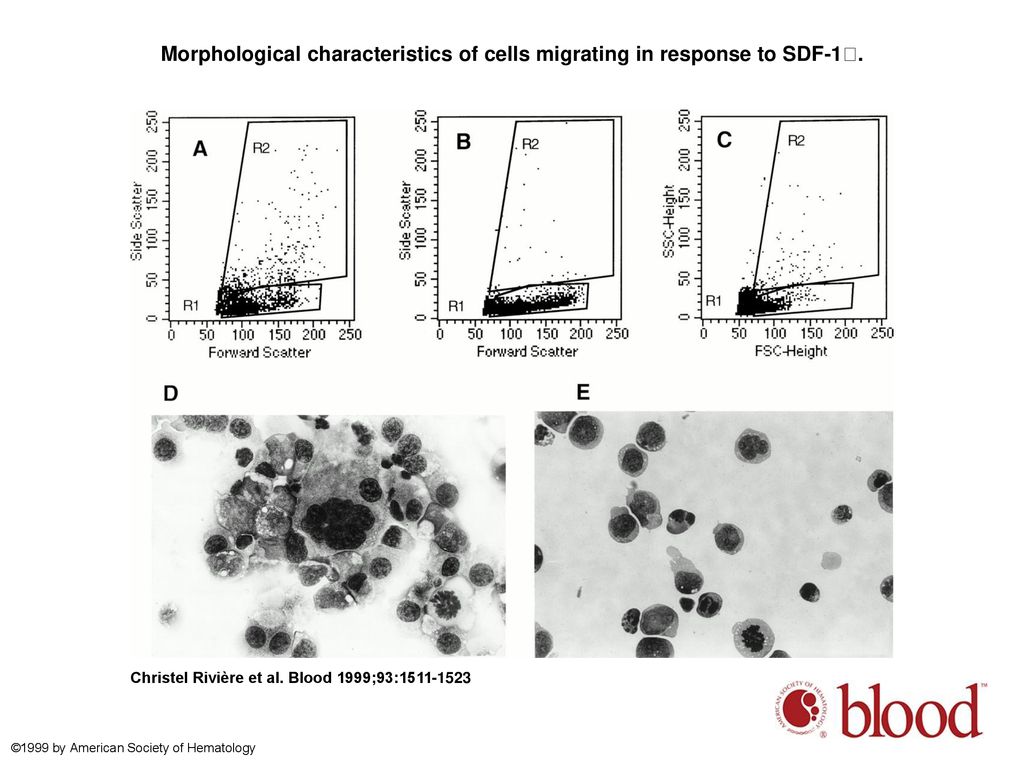 Morphological characteristics of cells migrating in response to SDF-1.
