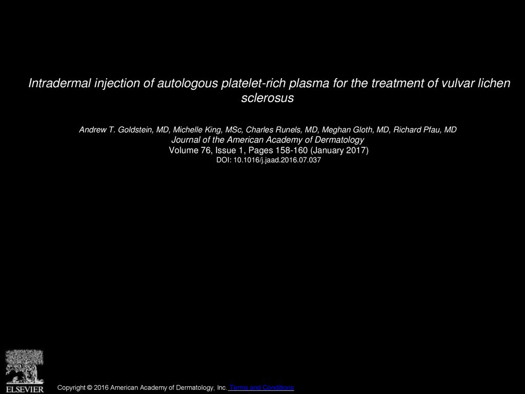 Intradermal injection of autologous platelet-rich plasma for the treatment of vulvar lichen sclerosus