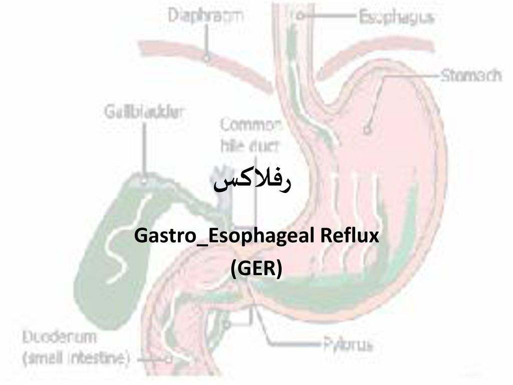 Gastro_Esophageal Reflux (GER)