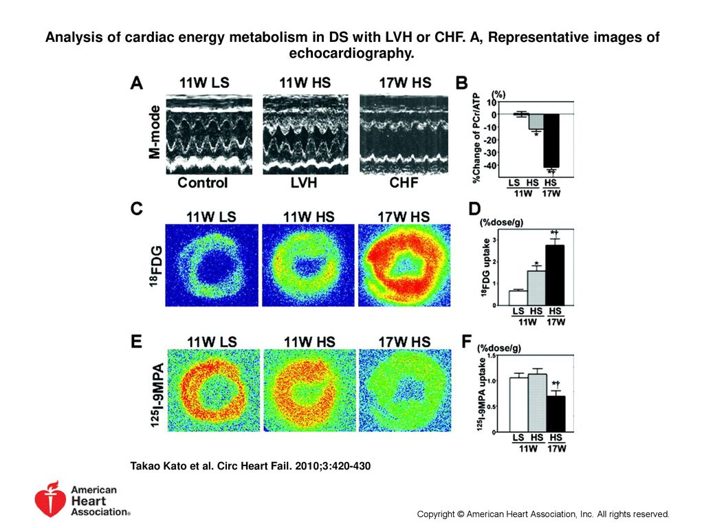 Analysis Of Metabolic Remodeling In Compensated Left Ventricular Hypertrophy And Heart Failureclinical Perspective By Takao Kato Shinichiro Niizuma Yasutaka Ppt Download