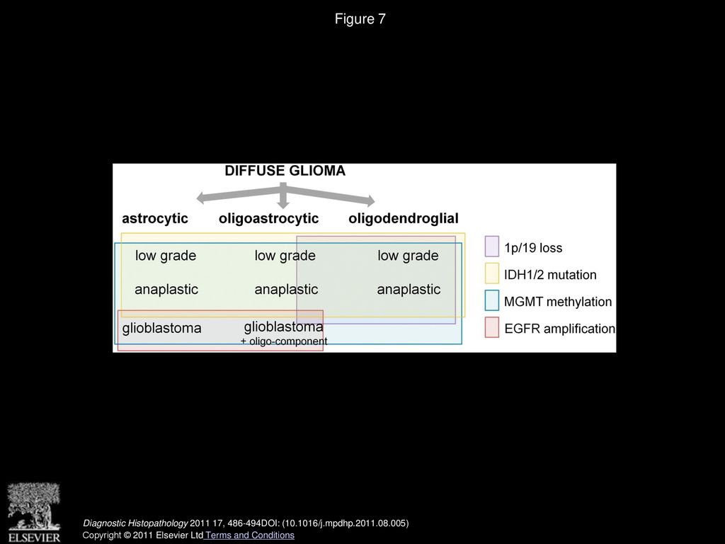 Figure 7 Indication of diffuse glioma types and malignancy grades in which particular molecular aberrations are relatively common.