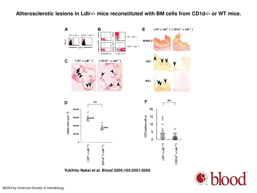 Atherosclerotic lesions in Ldlr-/- mice reconstituted with BM cells from CD1d-/- or WT mice.