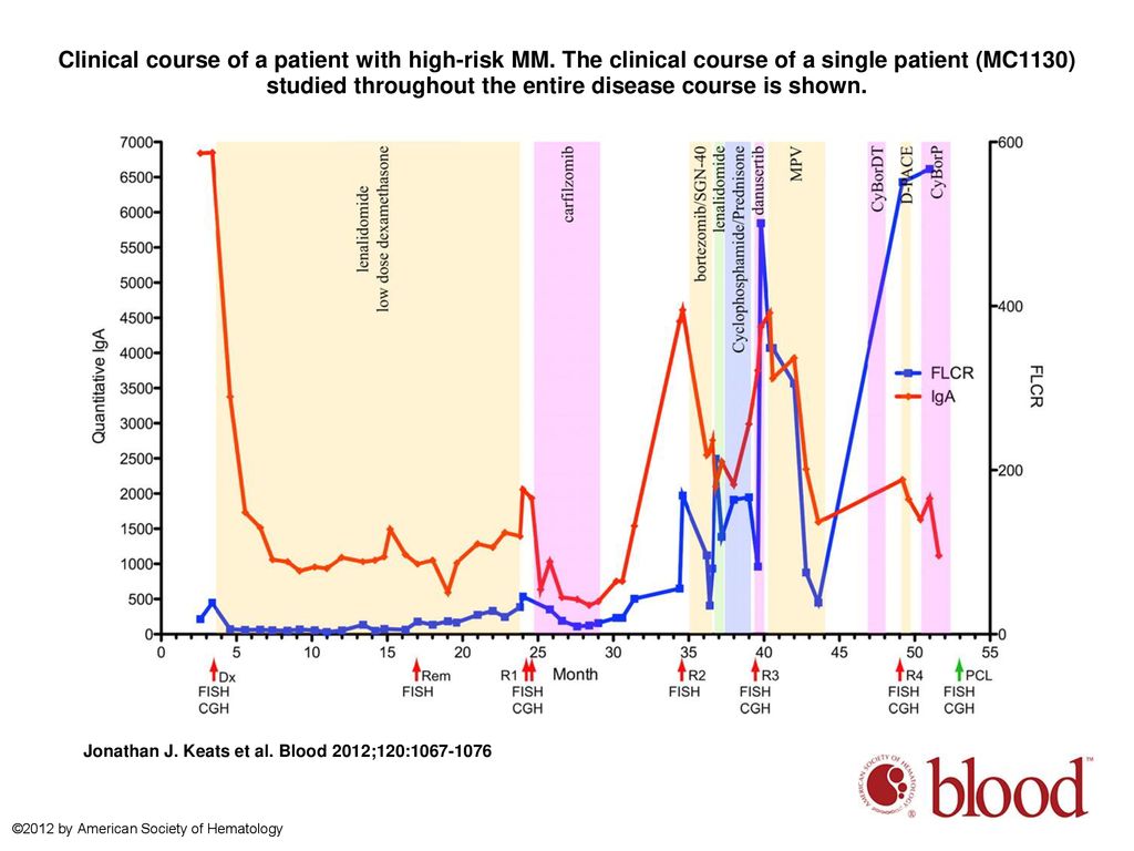 Clinical course of a patient with high-risk MM