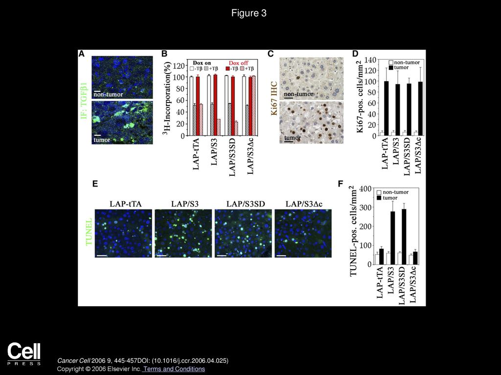 Figure 3 Smad3 promotes apoptosis of liver tumor cells in vivo